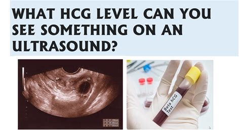 Hoping for the best but also want to be realistic. . At what hcg level can you see a gestational sac